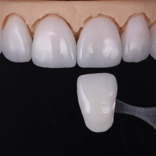 Natural Restoration DSD Lab 01