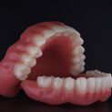 Denture dsd 3