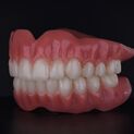 Denture dsd 4