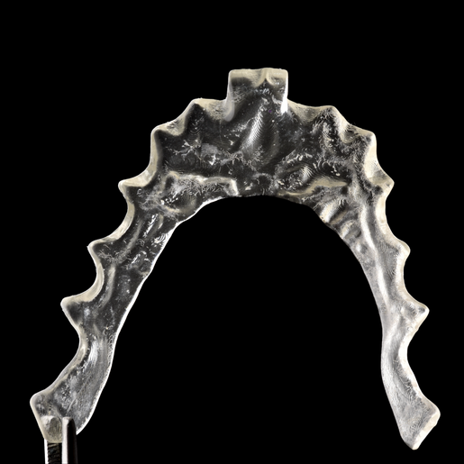 DSD ANTERIOR DEPROGRAMMER