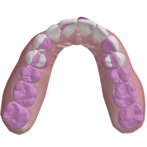 Oclusal 1