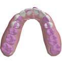 Oclusal 1