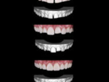 BACKGROUND IMAGES FOR HEADERS ON THE DIGITALSMILEDESIGN WEBSITE D2 4