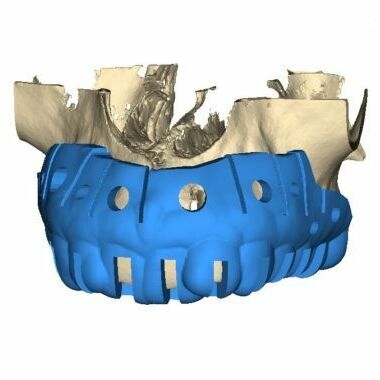 DSD SFOT Guide design