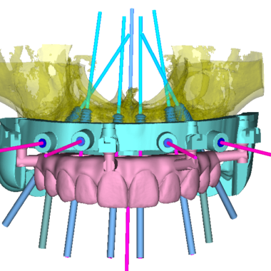 DSD Clic Guide Design