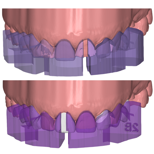 DSD Direct Pressed 3