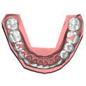 2 DSD Lower Pretreatment oclussal view