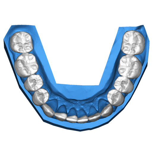 4 DSD Lower post treatment oclusal view