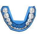 4 DSD Lower post treatment oclusal view
