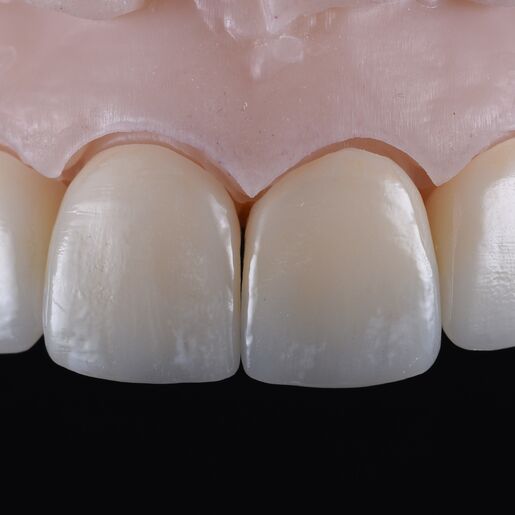 Natural Restauration 4