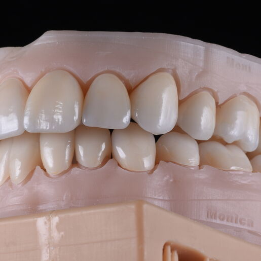 Natural Restauration 5