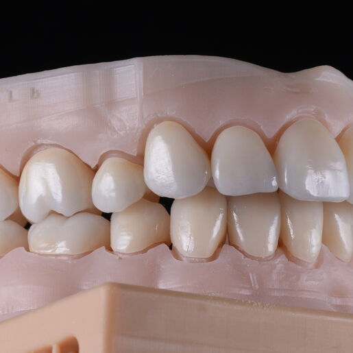 Natural Restauration 6