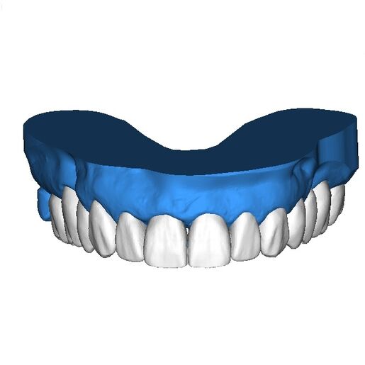 DSD Reduction Guides Design 3
