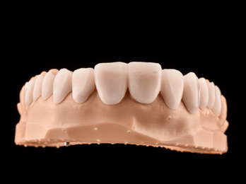 DSD Shell Manufacture